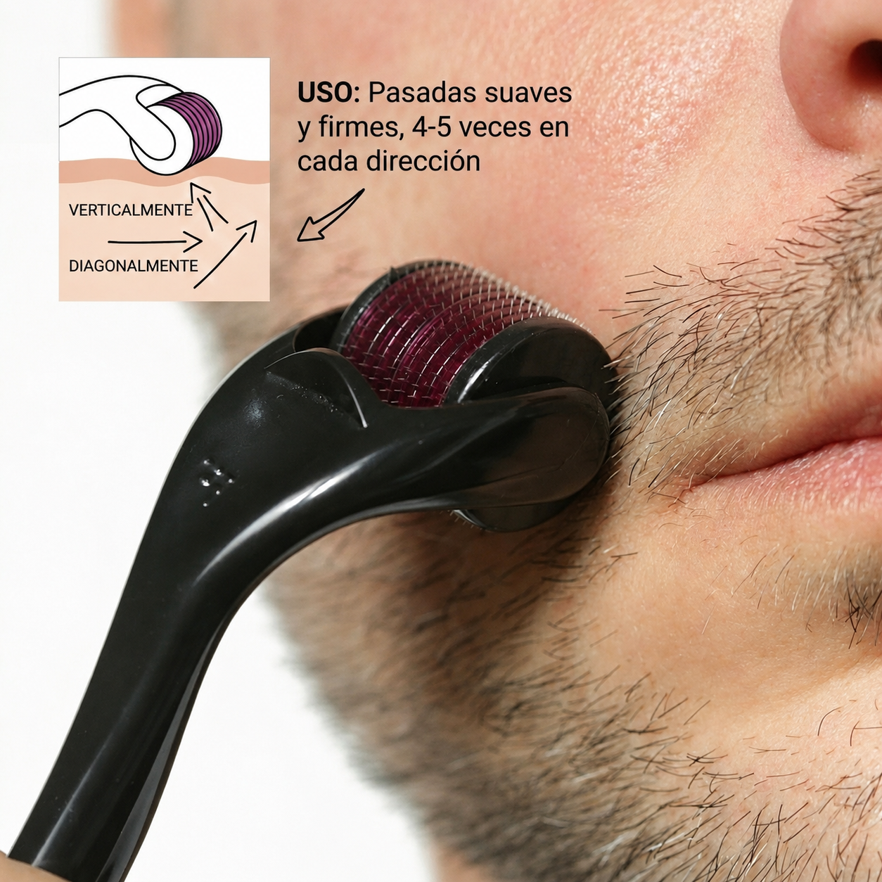 Derma Roller 540 Agujas – 0.50mm | Microagujas para Regeneración y Absorción de Minoxidil | El Dorado Products